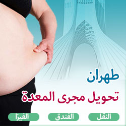 تحويل مجرى المعدة في طهران