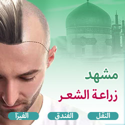 عرض زراعة الشعر في مشهد