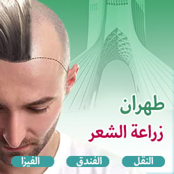 عرض زراعة الشعر في ايران