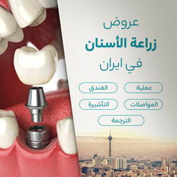 زراعة الاسنان في ايران