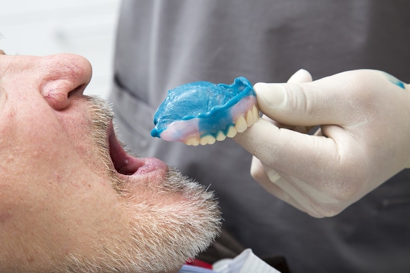 يساعد التبطين على التعود على طقم الاسنان