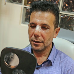 دكتور من العراق يجري عملية الانف في ايران