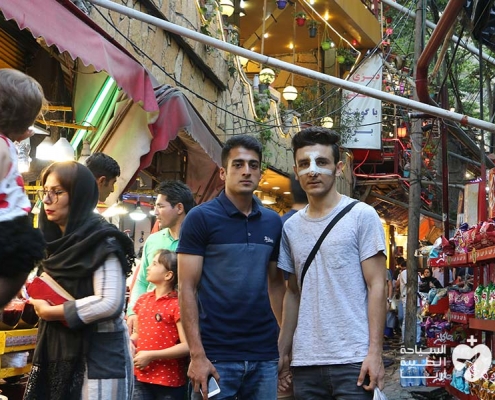 شاب من النمسا يجري تجميل الانف في ايران