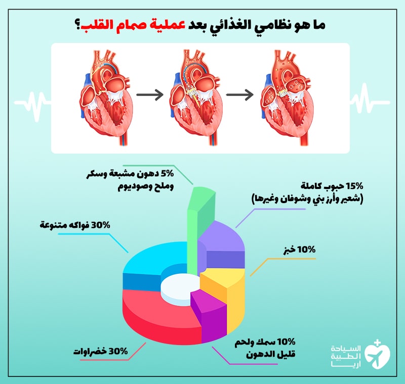 النظام الغذائي بعد عملية صمام القلب