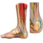 Orthopedics in Iran Orthopedics in Iran