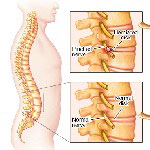 Orthopedics in Iran Orthopedics in Iran