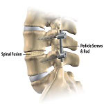 Orthopedics in Iran Orthopedics in Iran
