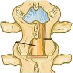 Orthopedics in Iran Orthopedics in Iran