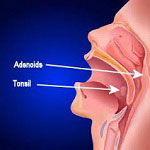 Ear, nose and troat in Iran - ENT in Iran Ear, nose and troat in Iran - ENT in Iran