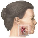Ear, nose and troat in Iran - ENT in Iran Ear, nose and troat in Iran - ENT in Iran