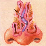 Ear, nose and troat in Iran - ENT in Iran Ear, nose and troat in Iran - ENT in Iran