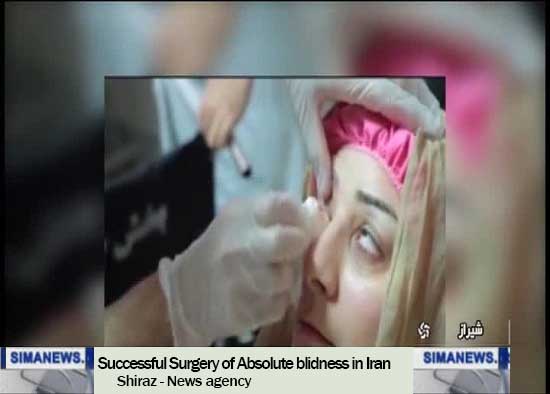 eye surgery for treating blindness in iran