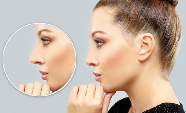 Nose Job Tips