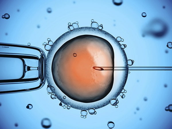 IVF or fertility treatment