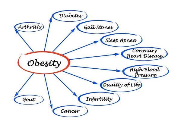 obesity related diseases
