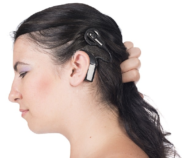 cochlear implants in adults
