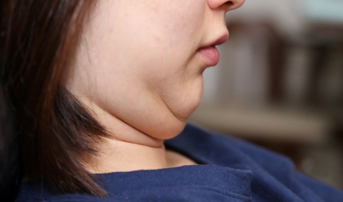 girl profile with double chin