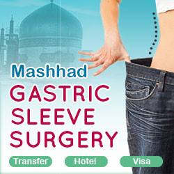 gastric sleeve in Mashhad