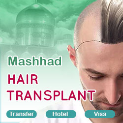 hair transplant package in Mashhad