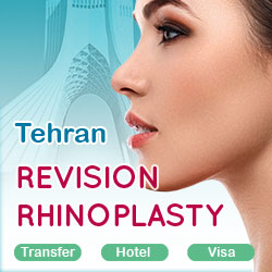 revision rhinoplasty package in Tehran