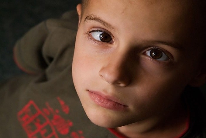 boy with crossed eyes or strabismus looking up