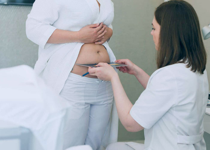 doctor evaluating the patient's condition before getting tummy tuck surgery to see how much fat should be removed
