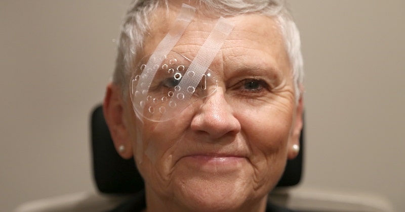 smiling man with a transparent eye shield after cataract surgery