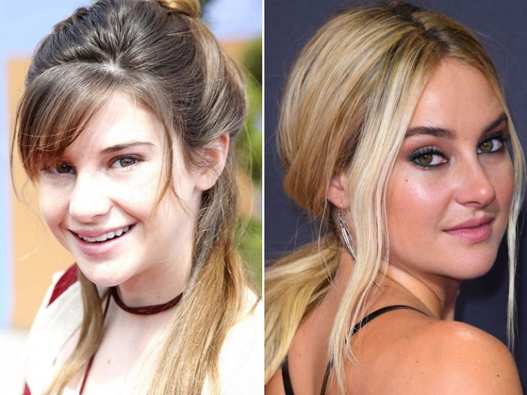 How To Tell If Someone Has Had a Nose Job? AriaMedTour