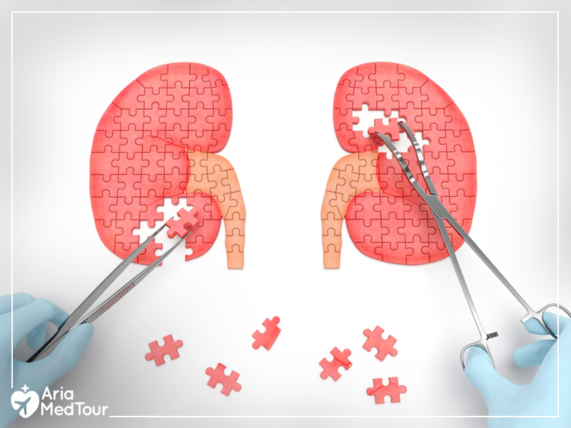 a surgeon putting together a puzzle of kidneys with surgical scissors