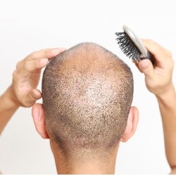 bald man with short hair holding a hair brush