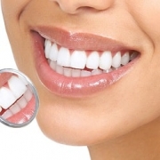 What Are Pros And Cons Of Dental Veneers | AriaMedTour