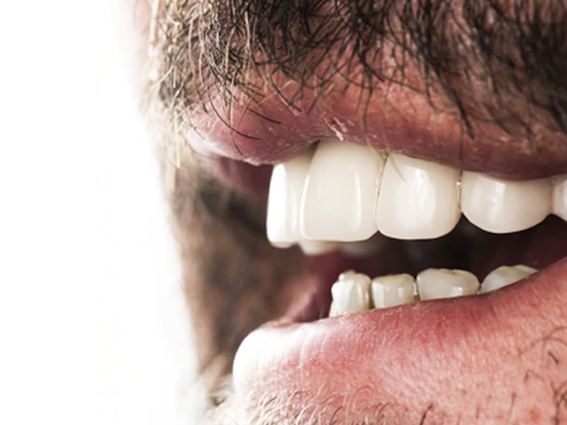 close-up photo of a smile of a man with white teeth