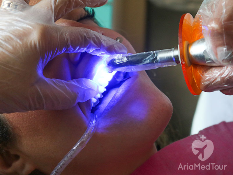woman wearing protective glasses in dental office getting teeth whitening with light beams