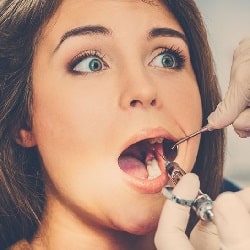 woman with open mouth getting dental work done