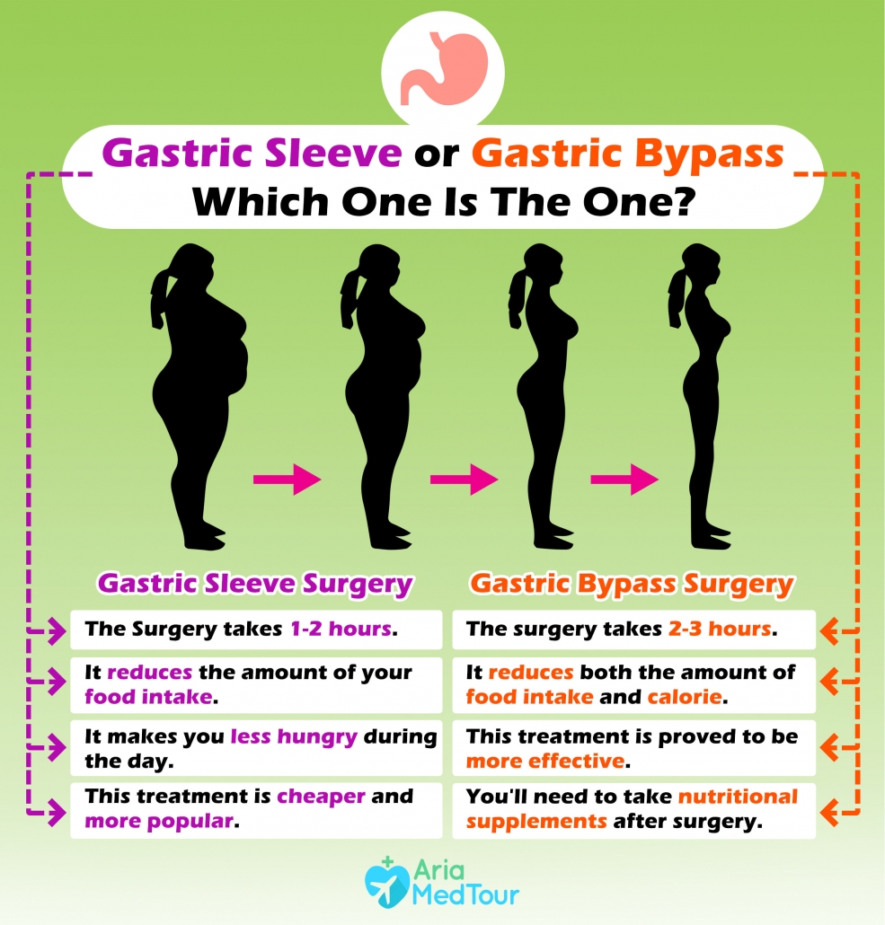 Gastric Bypass Vs Gastric Sleeve A Close Comparison AriaMedTour