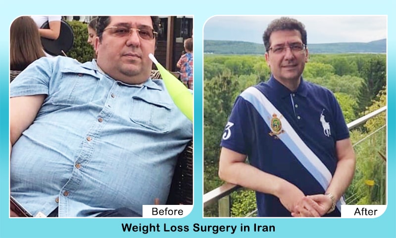 weight loss Before After iran