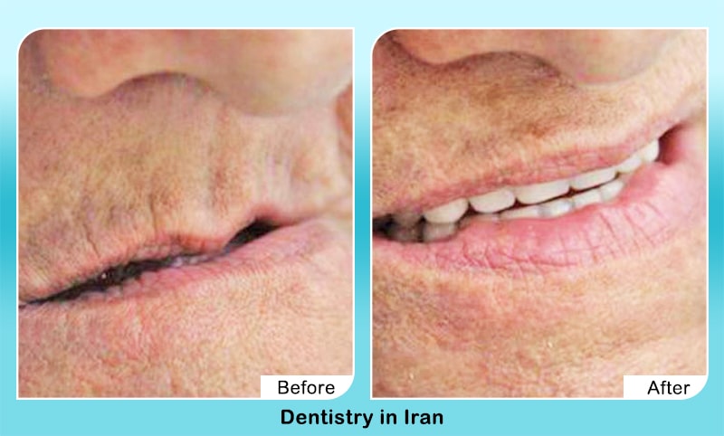 Dentistry in Iran