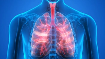 Lung Cancer treatment in Iran