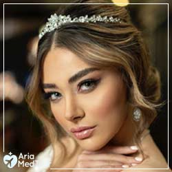 Canthoplasty In Iran Top Eyelid Surgeons Ariamedtour