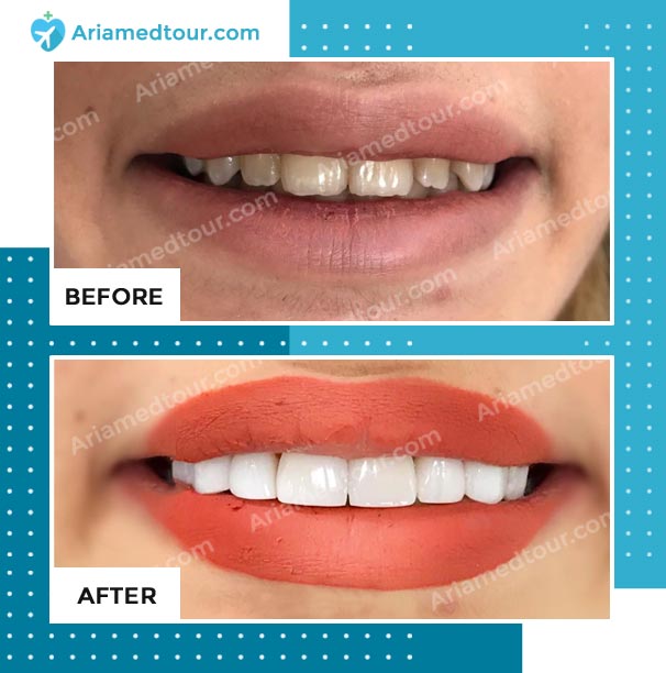 Dentistry Before and After Photos