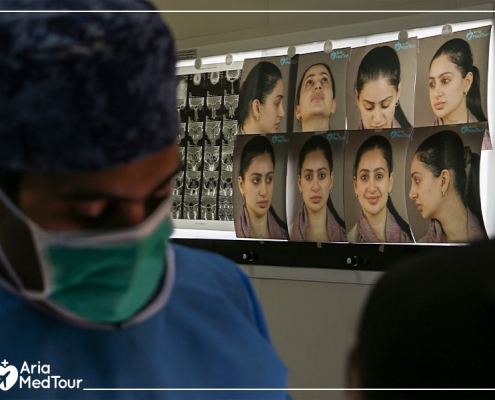 During revision rhinoplasty in Iran with AriaMedTour