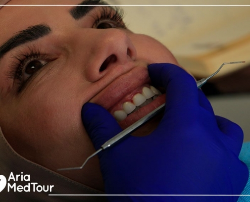 Australian patient in a dental work experience in Iran