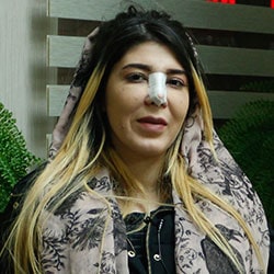 nose job experience in Iran