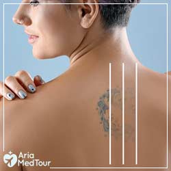 Tattoo Removal Pre/Post Care — Laser Tattoo and Permanent Makeup Removal  Edmonton