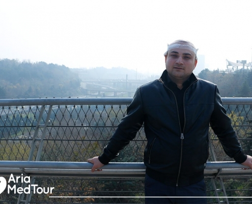 site seeing after hair transplant in Iran