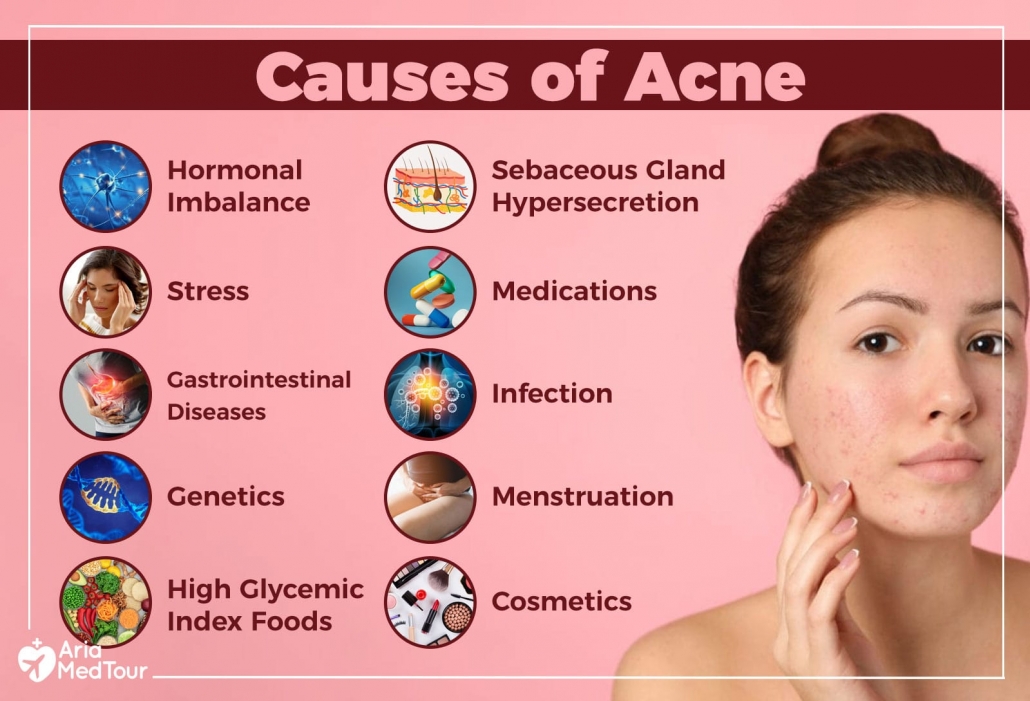 Ways To Get Rid Of Acne Without Cosmetic Procedures Ariamedtour