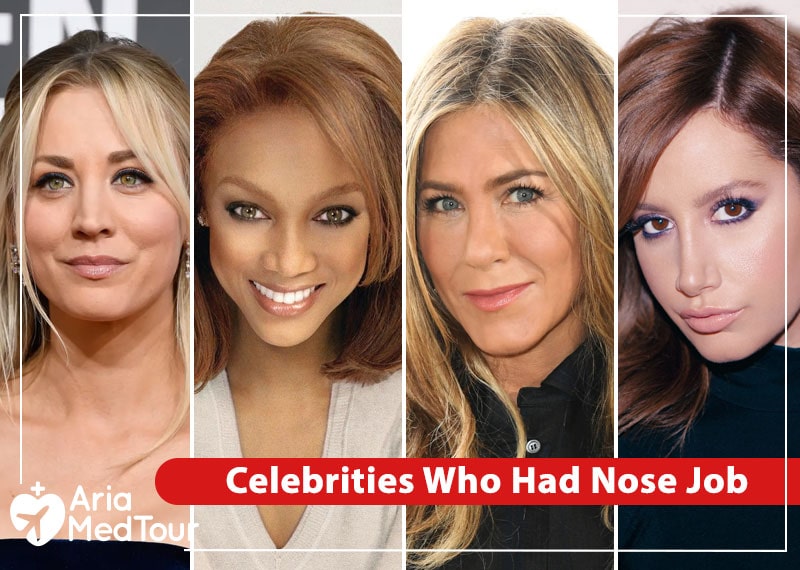 celebrities without noses