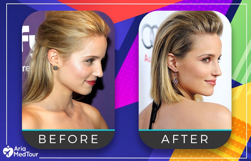 Dianna Agron nose job before after photo
