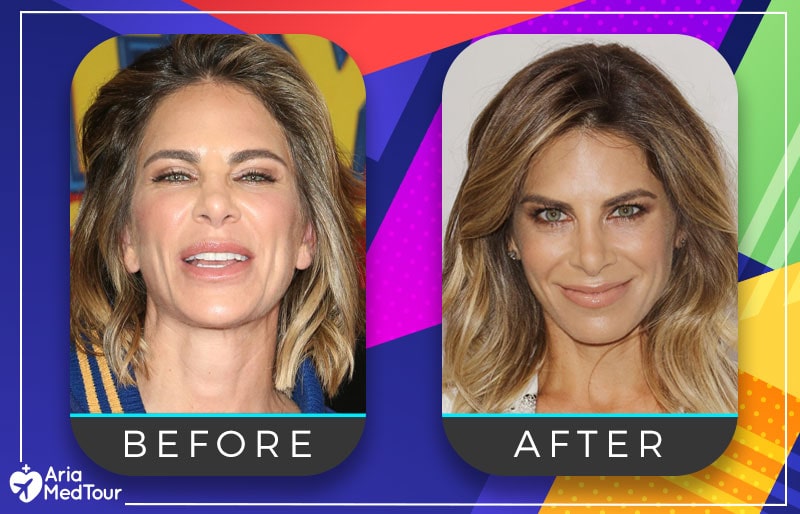 Jillian Michaels nose job before and after photo