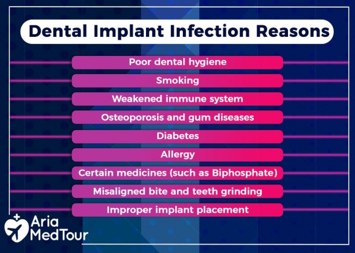 Dental Implant Infection Causes, Prevention and Treatments